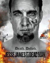 Jesse James Following the Tiger Plan, Checks into Sex Rehab