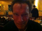 Arnold Schwarzenegger Injured On Set