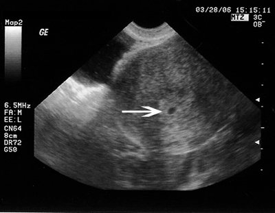 14+weeks+pregnant+ultrasound