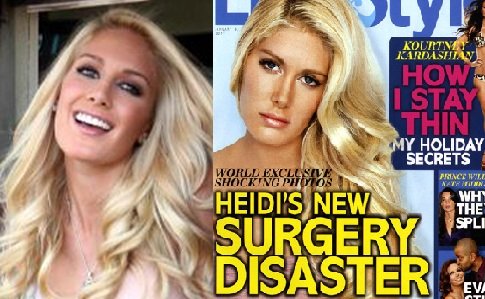 heidi montag plastic surgery disaster. Heidi Montag is the latest