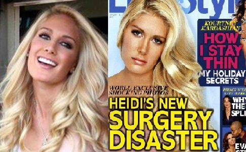 Heidi Montag is the latest heidi montag plastic surgery disaster. Heidi Montag is the latest