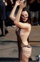 Rose McGowan: Rose McGowan Has Partial Elbowectomy